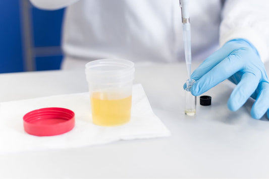 Un medico analizza un campione di urina